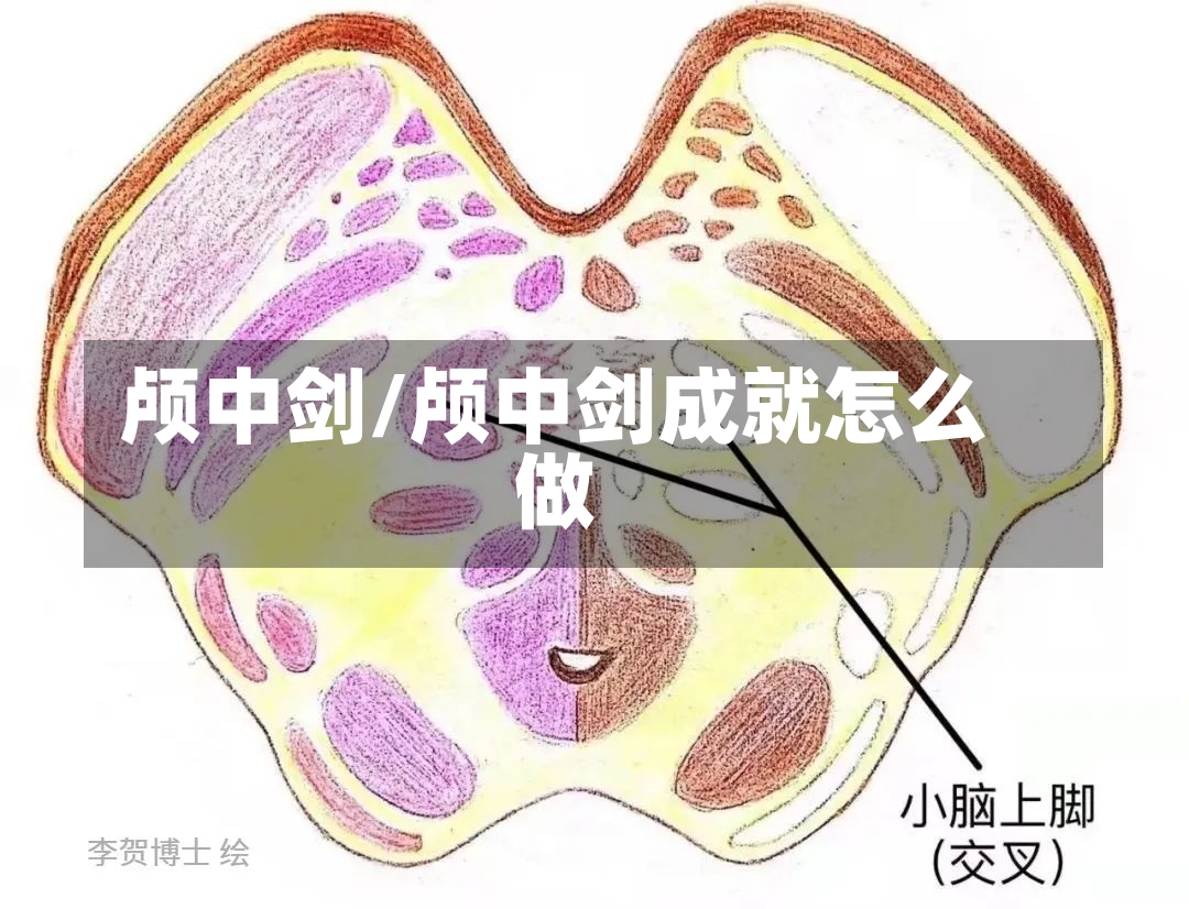 颅中剑/颅中剑成就怎么做-第2张图片-通任唐游戏